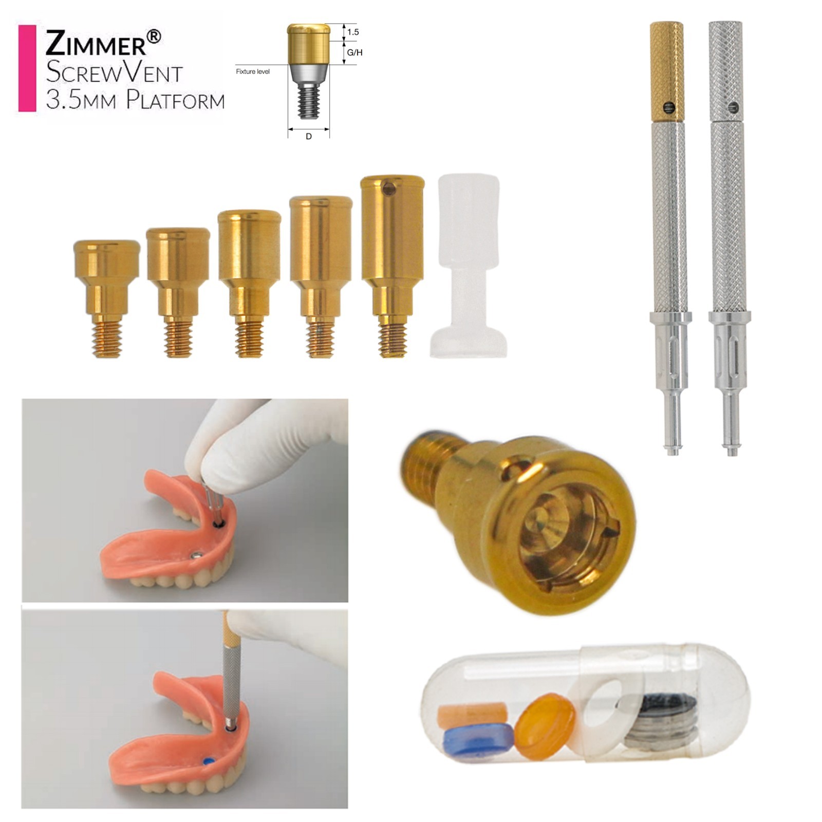 Overdenture Locator Abutment Removable Anchor Internal Hex BioHorizons Tapered