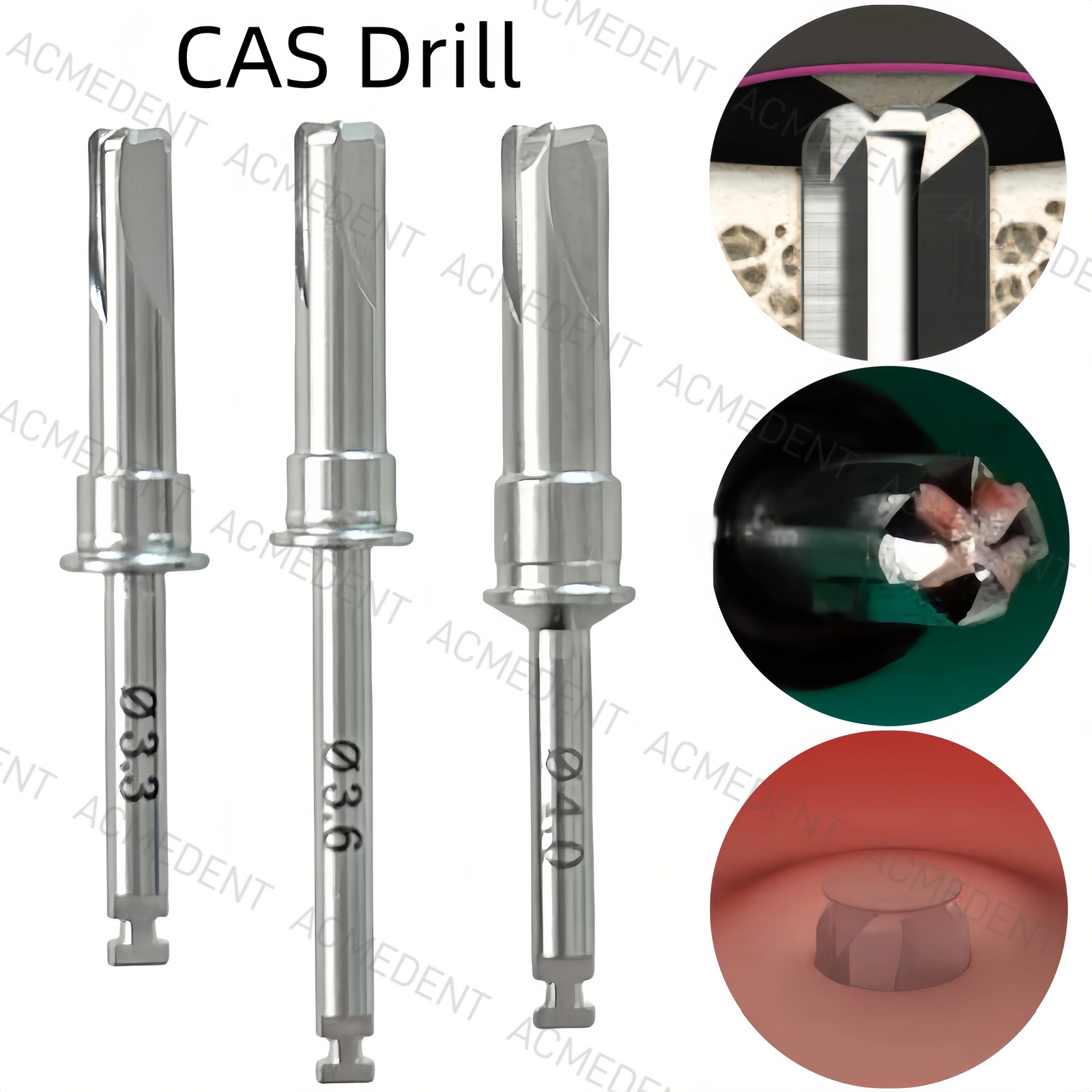 Dental Maxillary Sinus Lift Membrane Water Rising Hydraulic Lifter Aqua Tip Wate