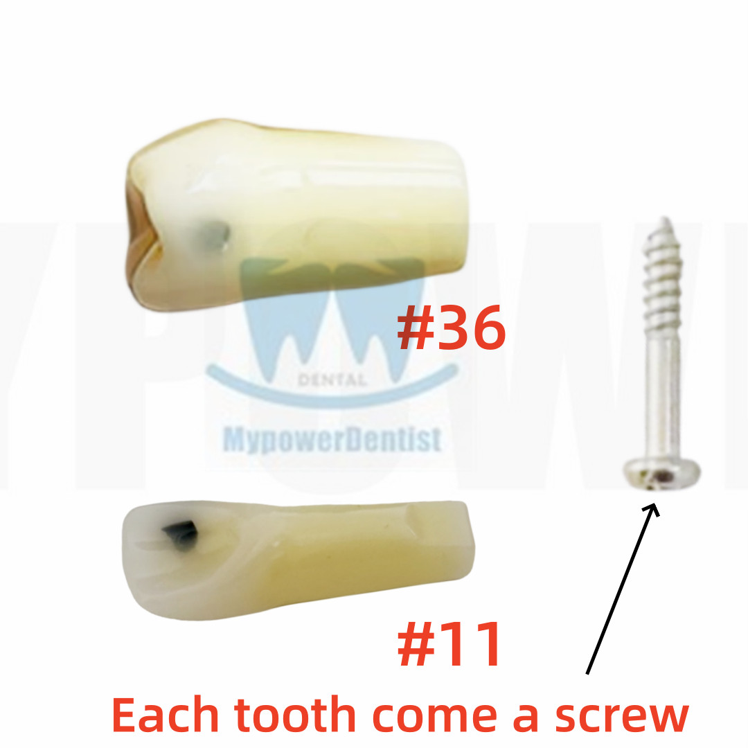 Dental Cavity Preparation/Vitro Decay Caries Model/Composite Resin Filling Model