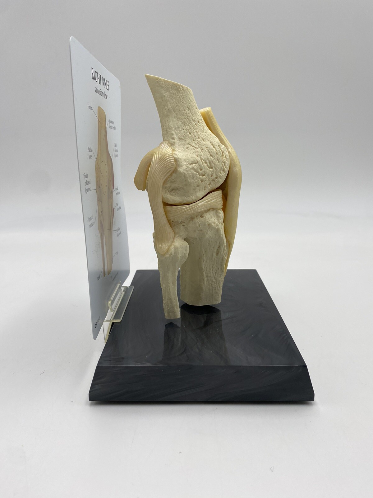 GPI Anatomical – GP1000 – Basic Knee Join Model