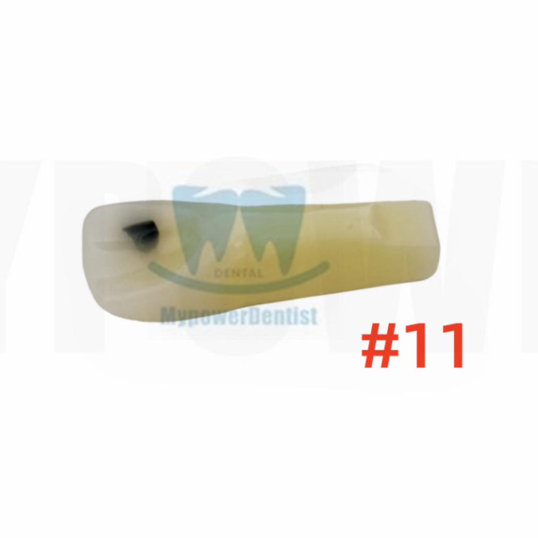 Dental Cavity Preparation/Vitro Decay Caries Model/Composite Resin Filling Model