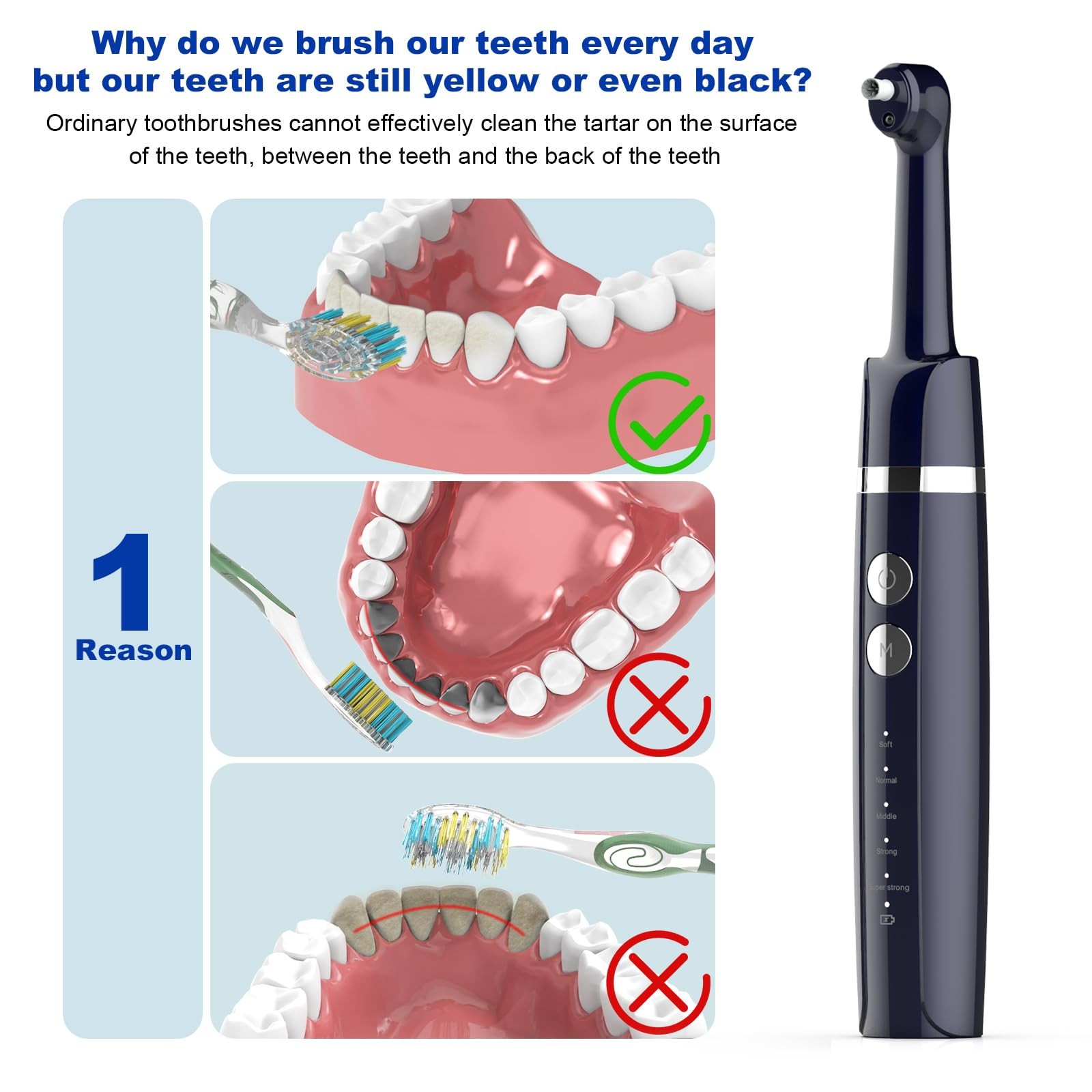 Tooth Polisher,Teeth Polishing Kit for Daily Cleaning,Polishing Then Whitening