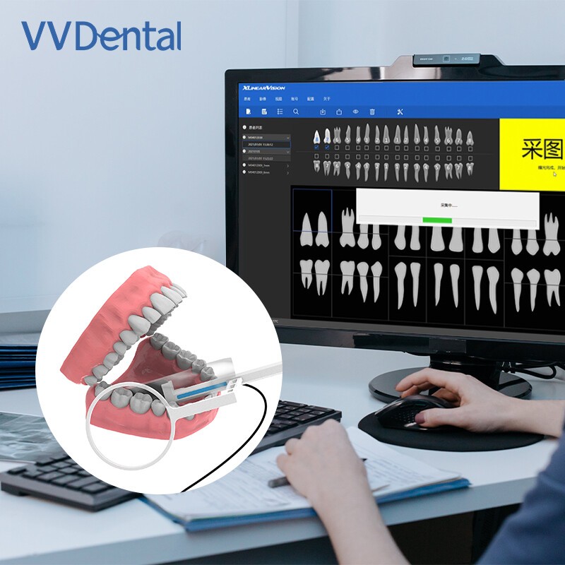 Dental Sensor Radiovisiograph Digital Sensor Intraoral Imaging System HD Image