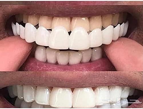 New Silicone Gel Smile Upper and Lower Cosmetic Teeth Tooth Cover Perfect Smile