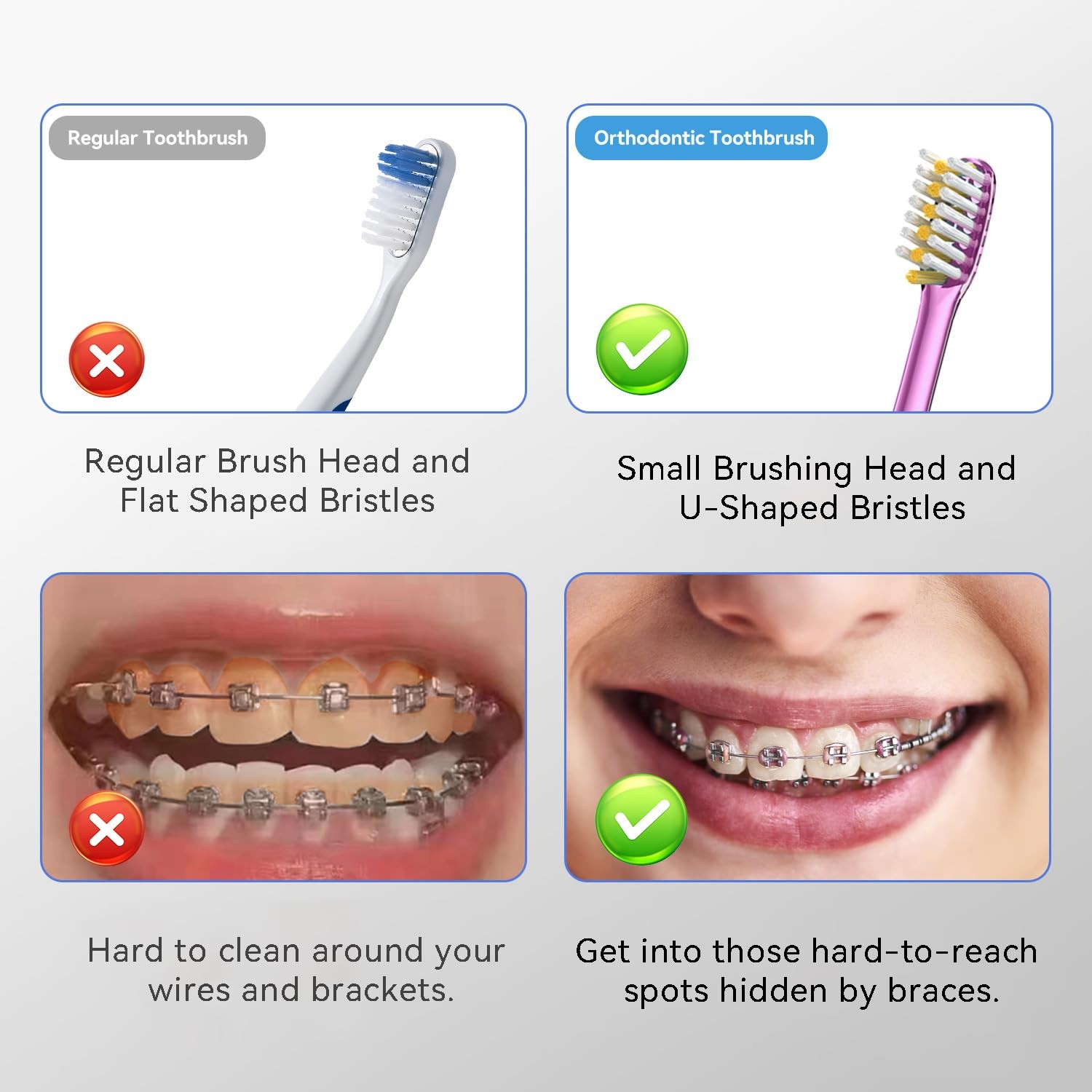 JTF Orthodontic Manual Toothbrush for Braces: 1 Count (Pack of 6), Pink-blue