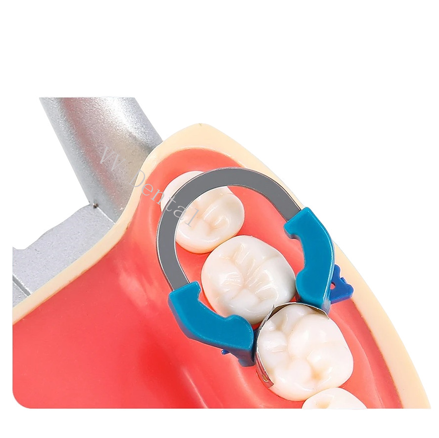 Dentist NITI Clamping Ring Dental Matrix Bands Ring Universal/Narrow/Deep Clamp