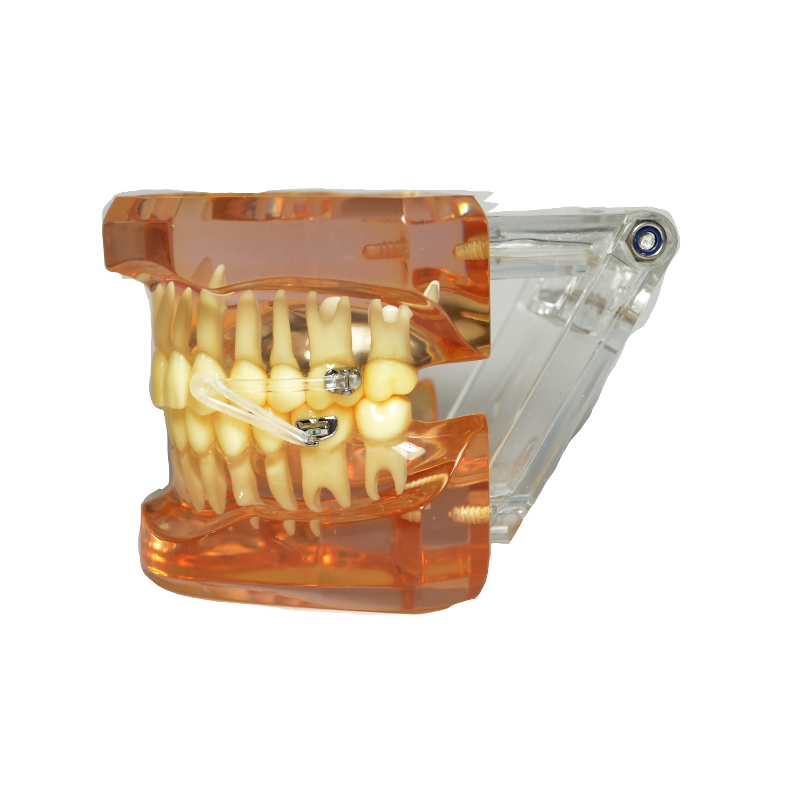 J&J Ortho™ BiteForce NC4 Orthodontic Clear Distalizing Bar Appliance (2/pair)