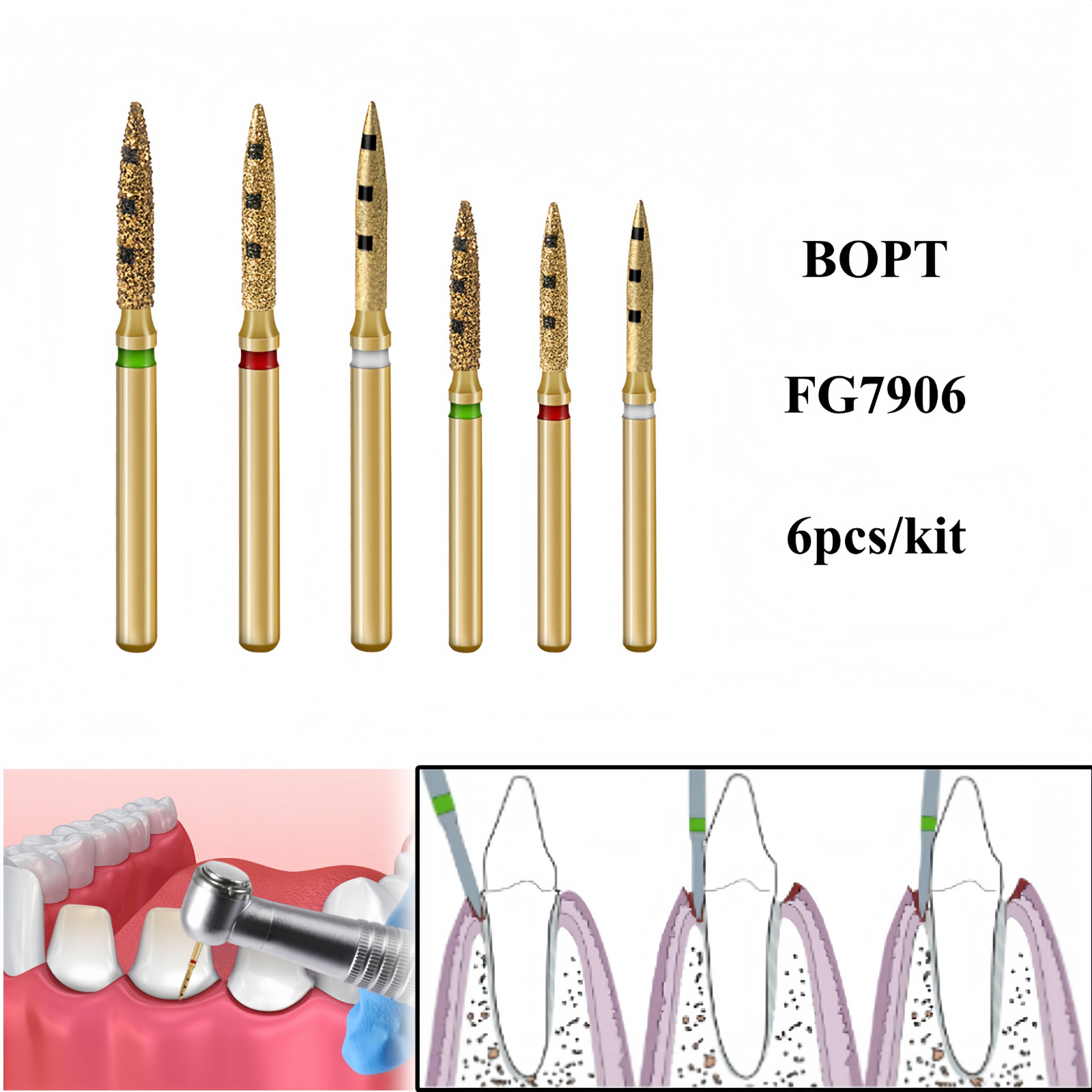 Dental BOPT FG Burs Vertical Diamond Biologically Oriented Preperation Technique