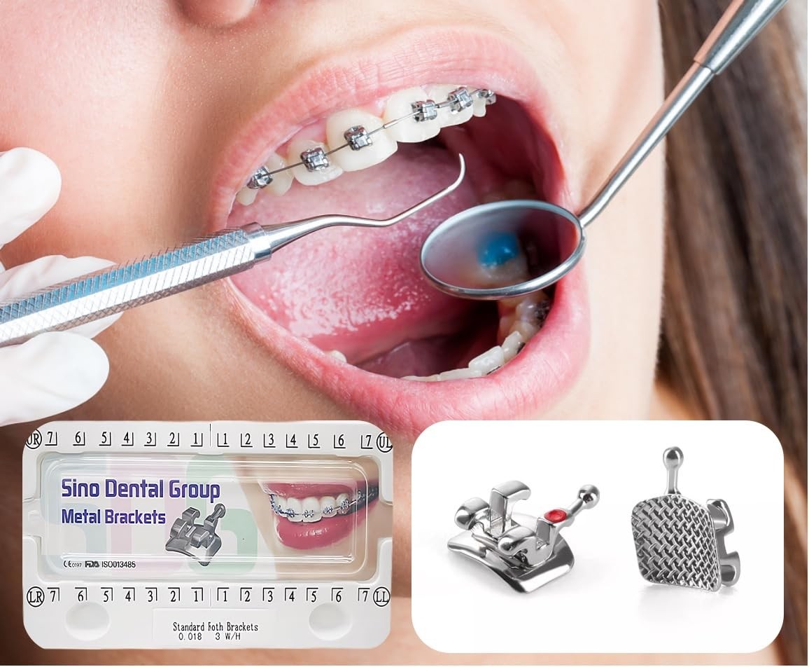Braces Kit – 200pcs/Box Bondable Metal Brackets For Teeth 0.022 Standard MBT