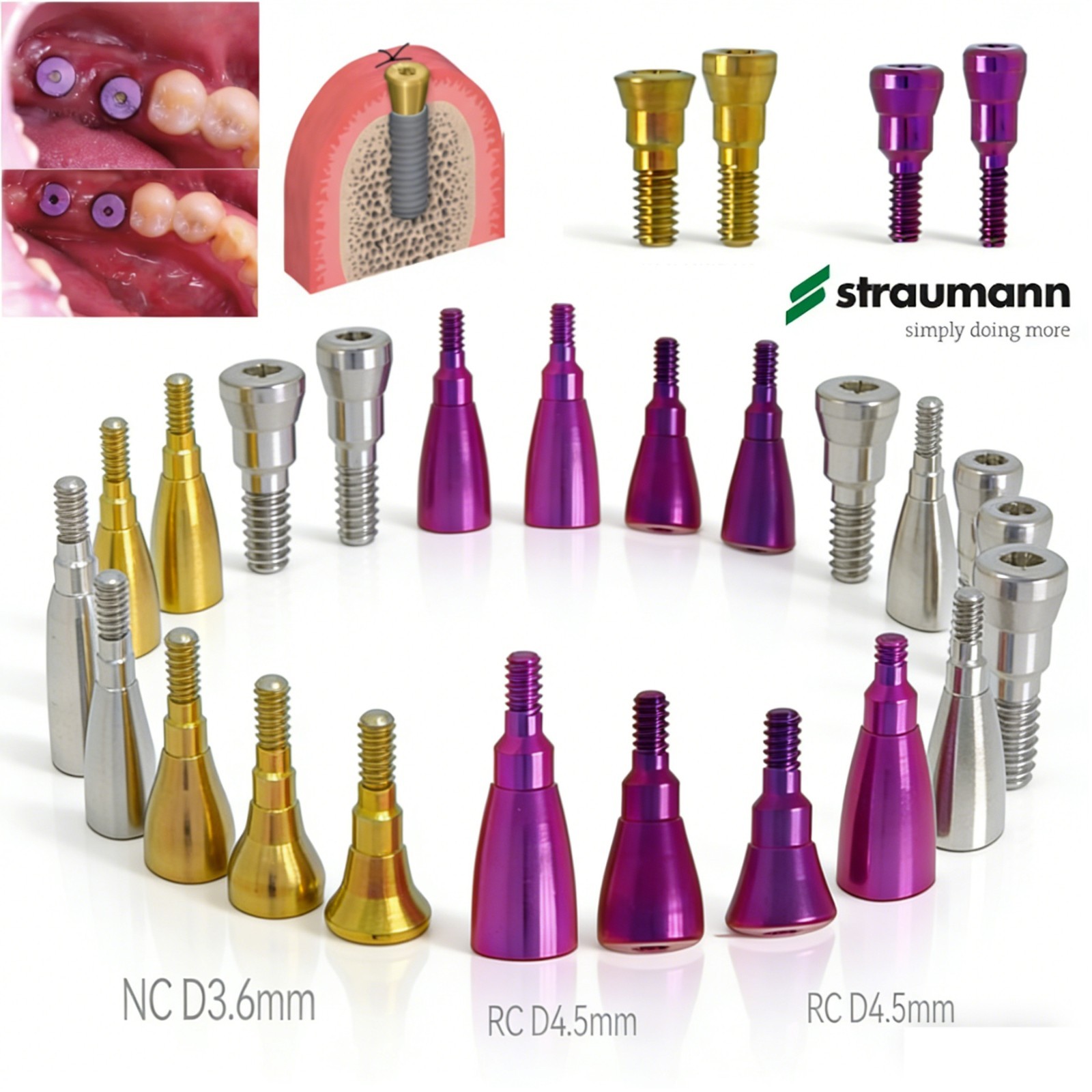 US Dental NC/RC Healing Abutment Closure Cap Bone Level Titanium Fits Straumann