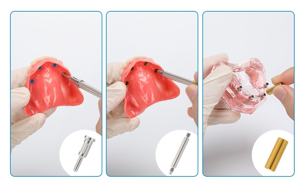 Fit Straumann Bone Level NC Locator Classic Overdenture Abutment Narrow Cross
