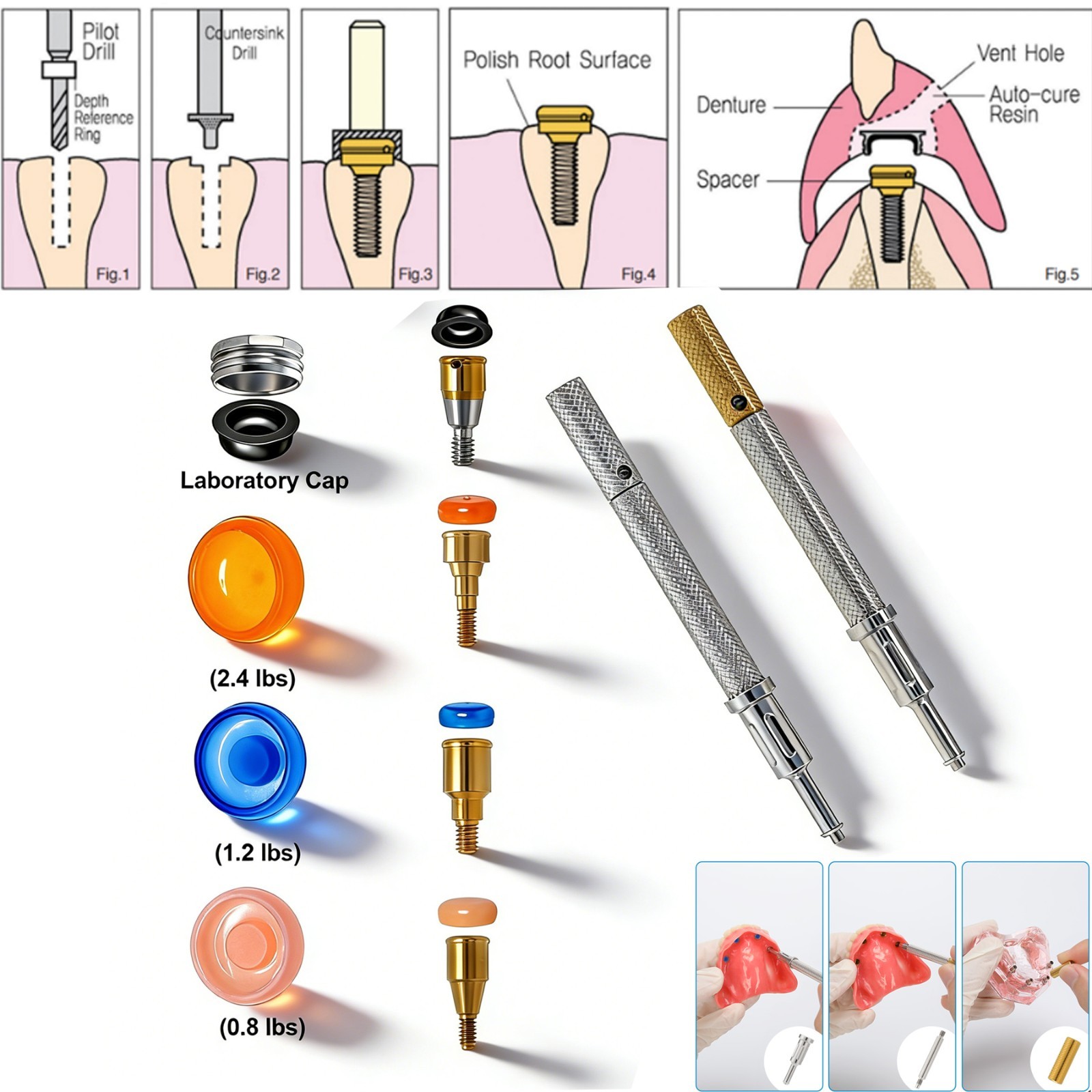 Overdenture Locator Abutment Removable Anchor Internal Hex BioHorizons Tapered