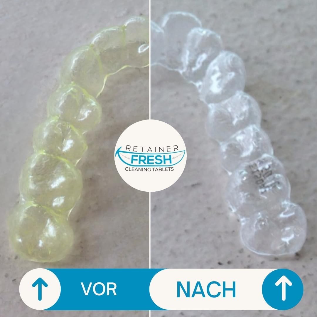 Retainer Cleaner Tablets – 120 4 Month 120 Tablets, White