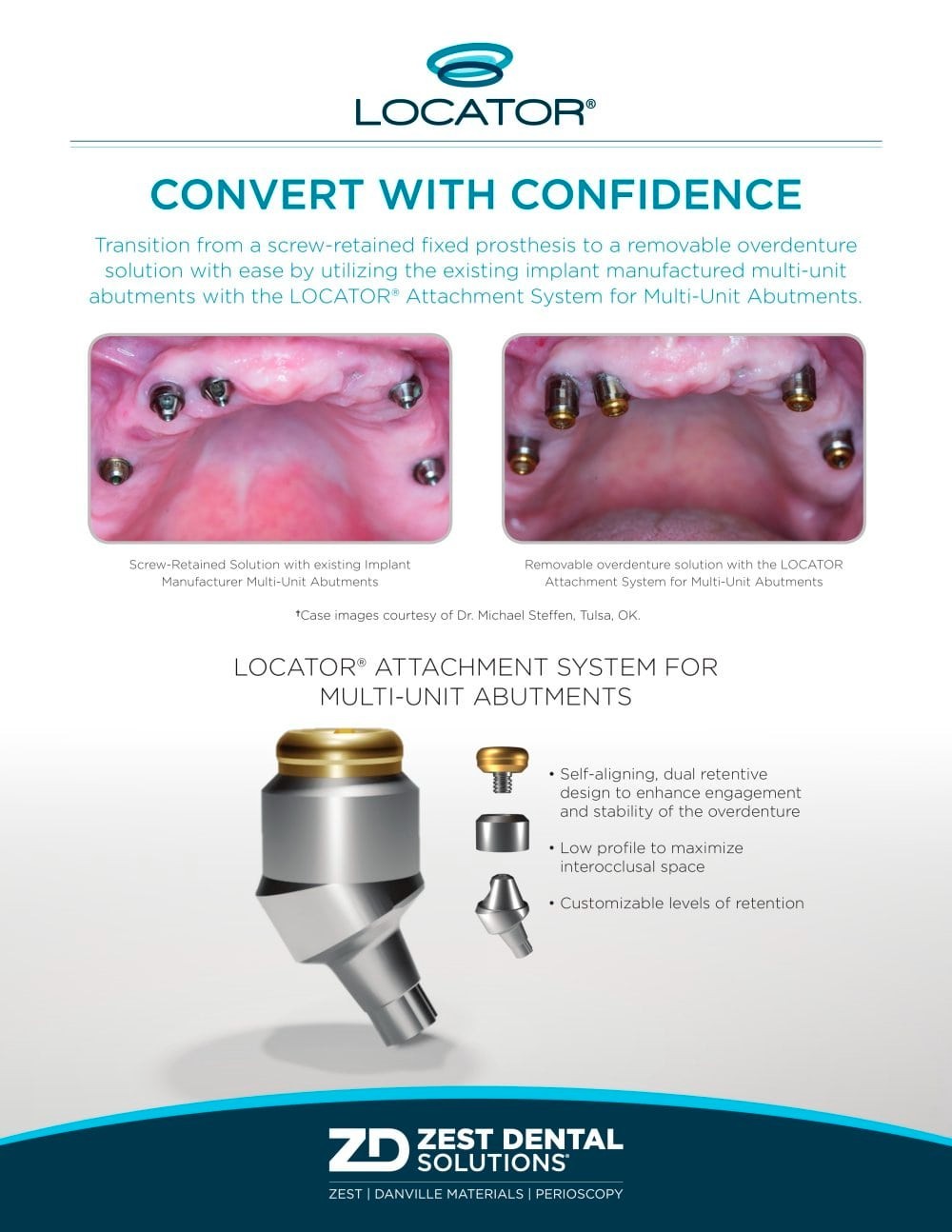 4.8mm Multi-Unit Locator Attachment Abutment Fit Hiossen/Nobel/3.0/5.0mm GH