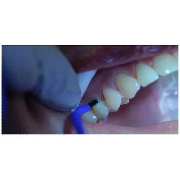 Dental GC Dentine Conditioner a Polyacrylic Acid Cavity Conditioner 6gm Bottle