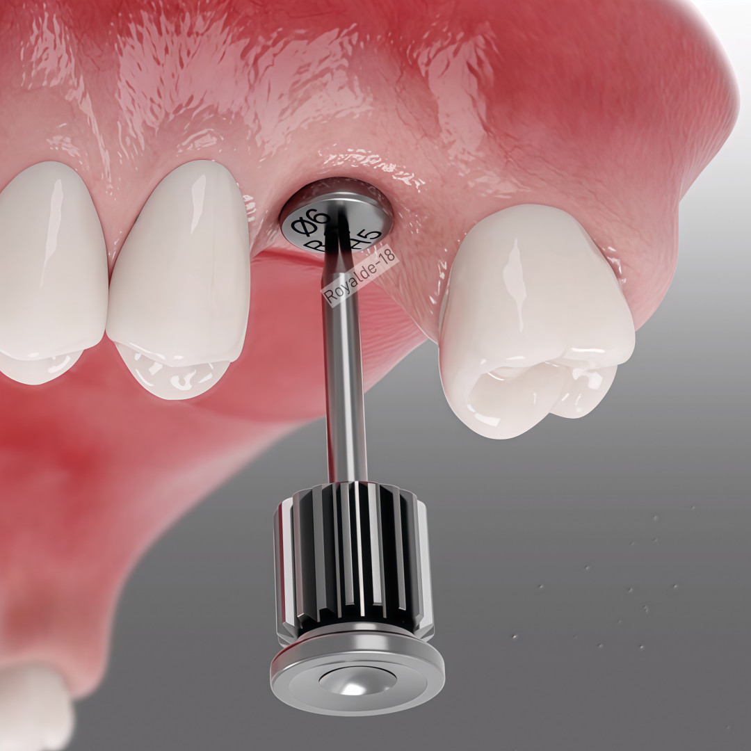 Dental Caps Healing Abutment/Lab Analog Mini Regular Platform Fits ostem Hiossen