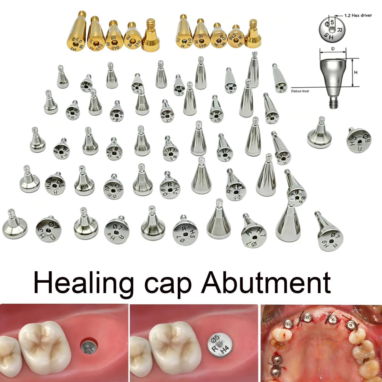 Dental Healing Abutment Mini Regular Cover Screw Fits Hiossen Implant 5/10/20Pcs