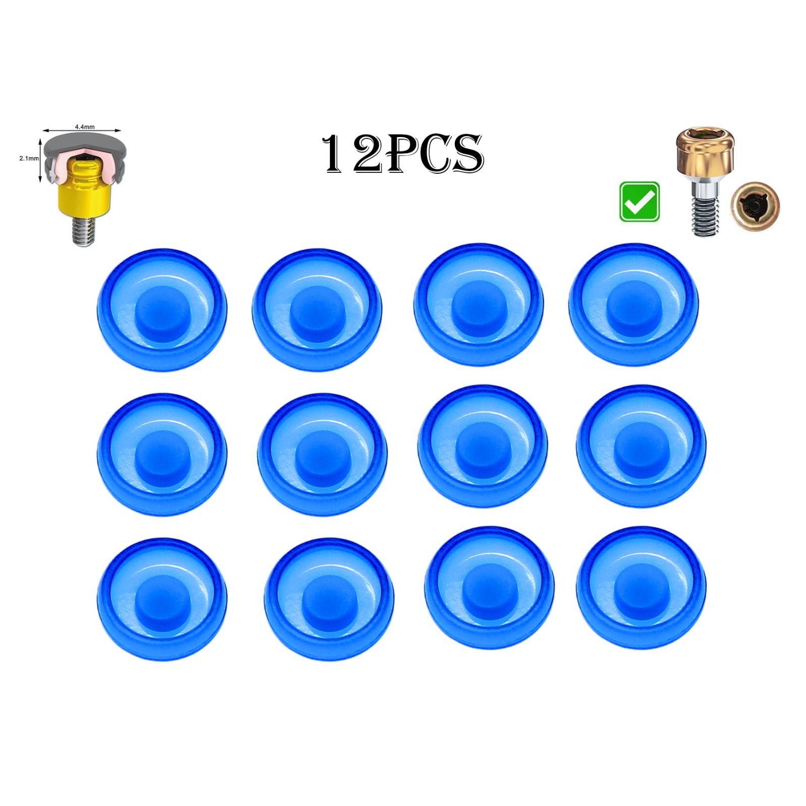 US Dental Overdenture Abutment Removable Male Caps Inserts Standard Blue 1.2 lbs