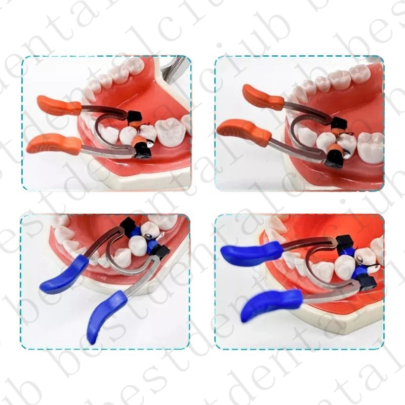 Dental Matrix Bands Ring Sectional Matrice Clamp Fit Palodent V3 System