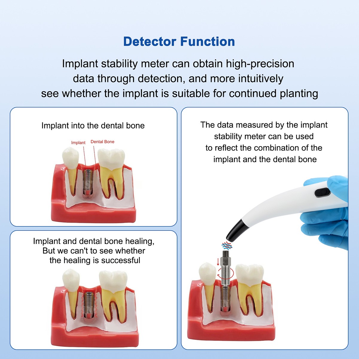 AZDENT Dental Osseointegration Monitor Implant Stability ISQ Measurement System