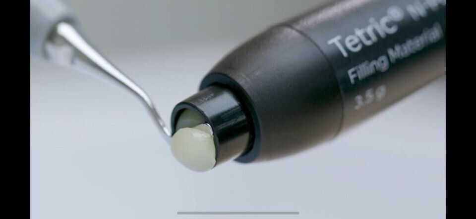 Ivoclar TETRIC N CERAM-2 Polymer Based Dental Restorative Composite 3.5gm