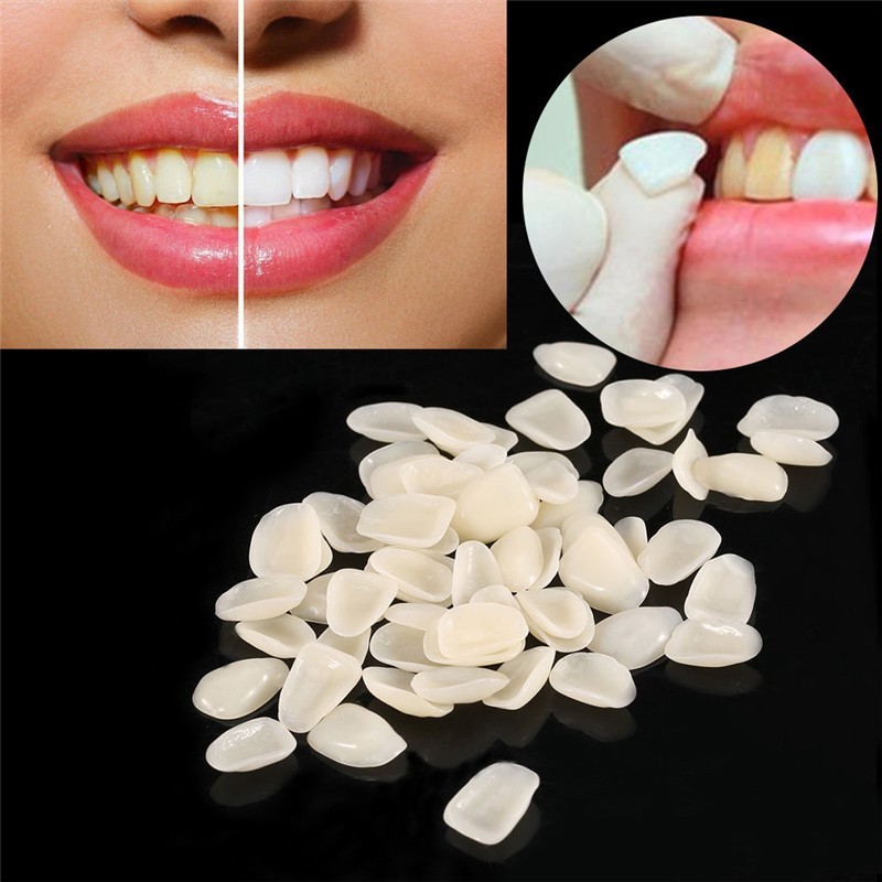 50Pcs/Pack Temporary Resin Dental Veneers A1 or A2 Upper Dental Veneers US