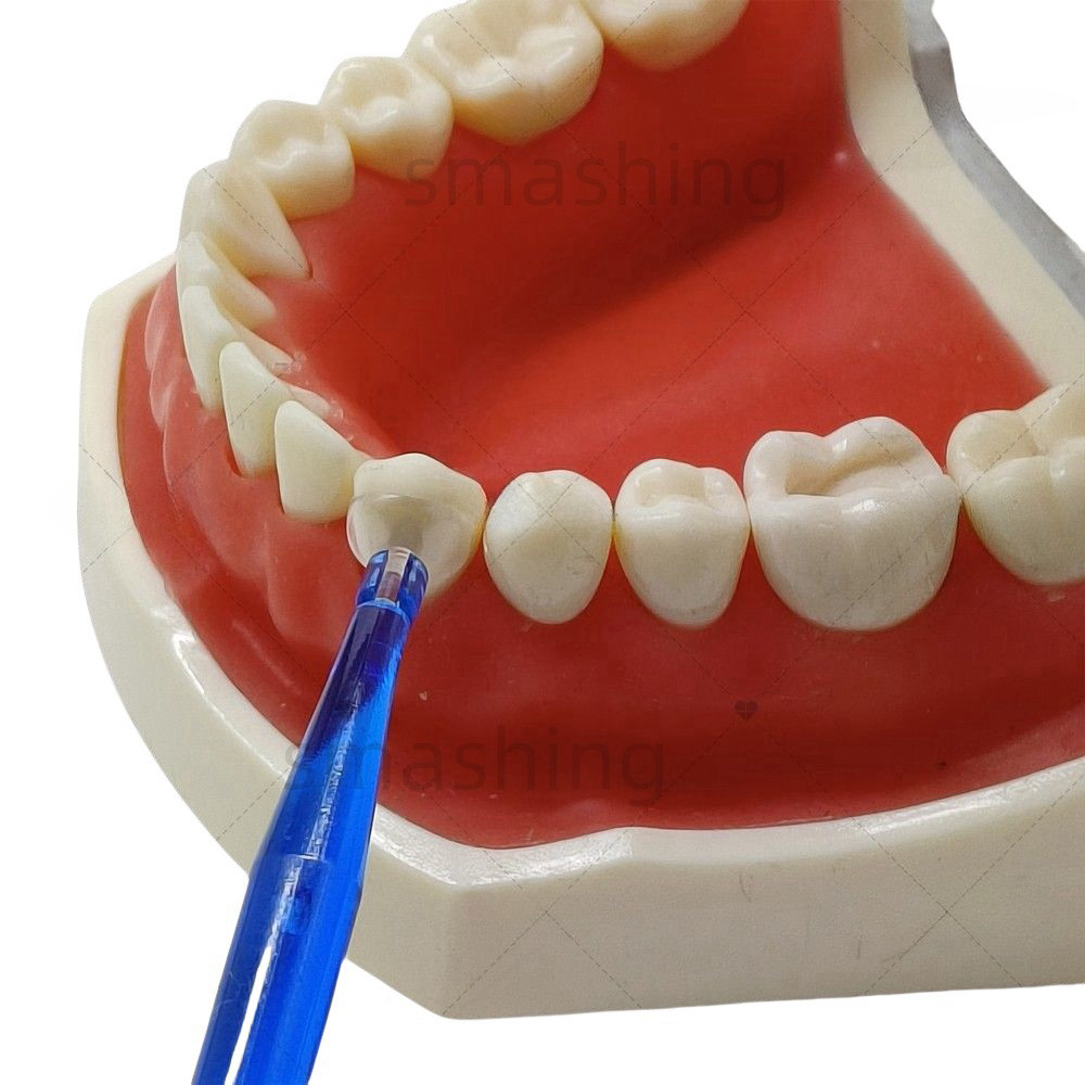 Dental Transparent Cervical Matrices Composite Gingival Retractor Clear Matrix