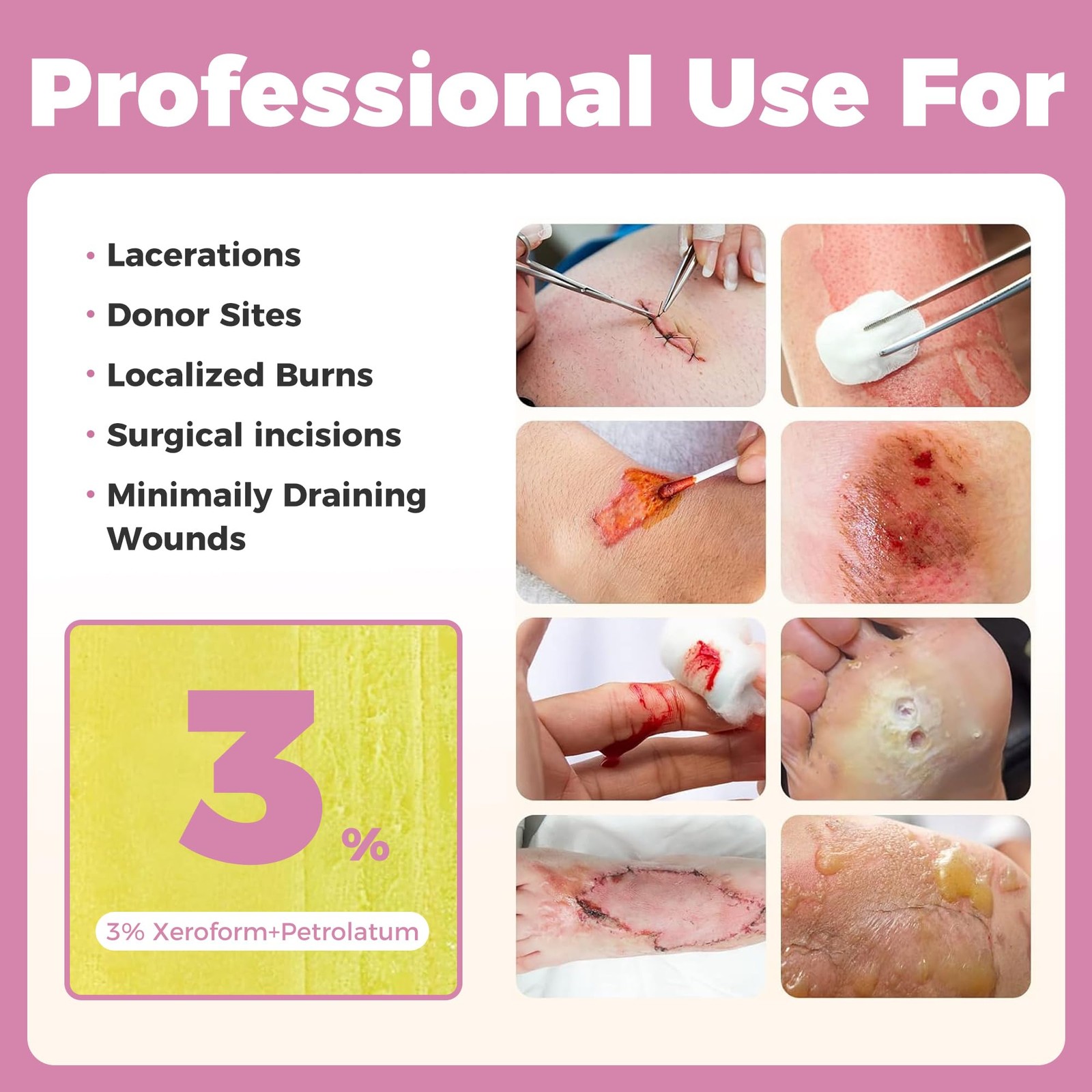 Xeroform Petrolatum Dressing – FSA-HSA, 5″x9″, 5″x9″ (Pack of 7)
