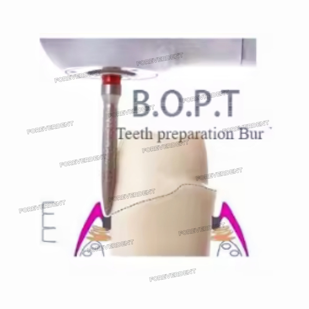Dental BOPT Preperation Burs Vertical Diamond FG7906 Oriented Technique 6pcs/kit
