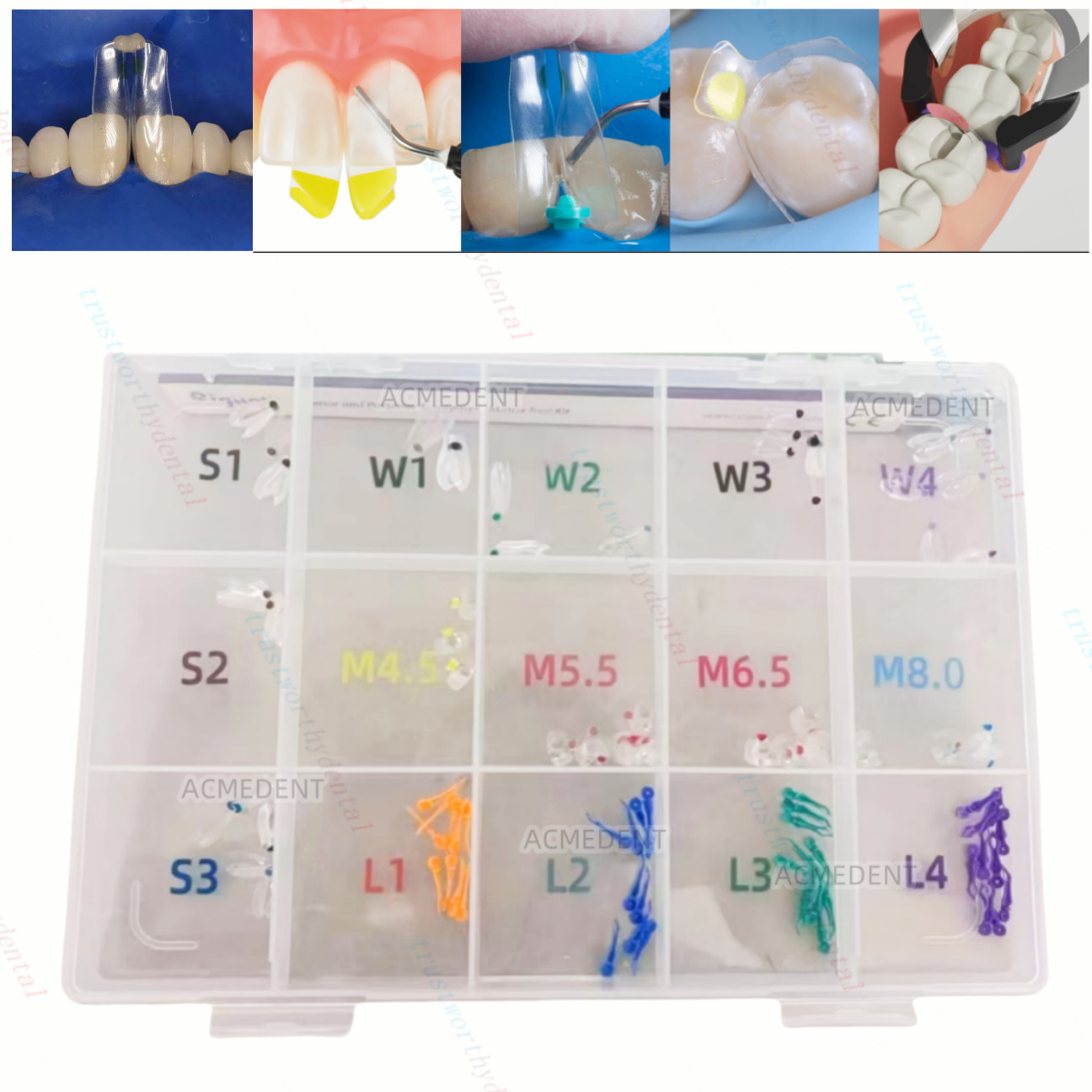 Clear Matrix Dental Anterior Matrices Posterior Class II Fit BioClear Fit Biofit