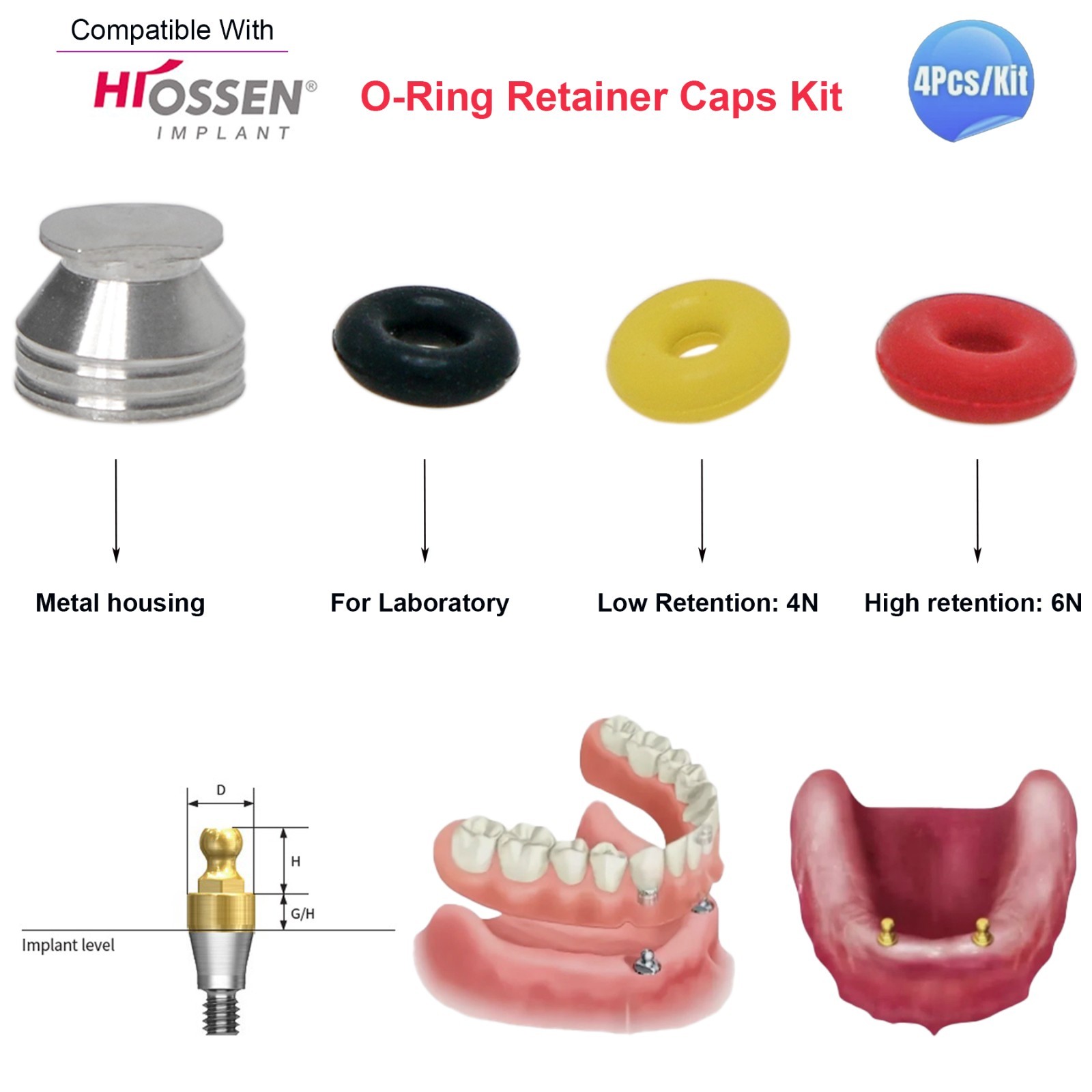 US Dental O-ring 4Pcs/Set for Ball Attachment Abutment Compatible Hiossen Osstem