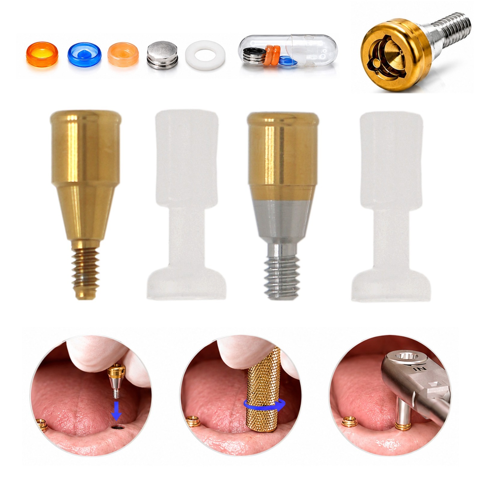 US Fit Nobel Active Locator Attachment Tapered Abutment NP/RP Conical Connection