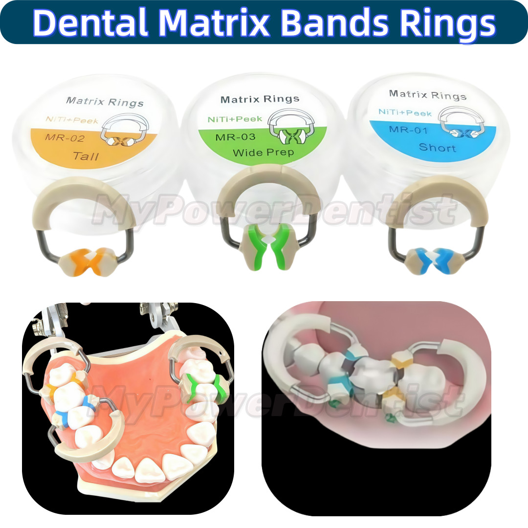 Dental Matrix Bands Ring Sectional Matrice Titanium Alloy Clamp Fit Palodent V3