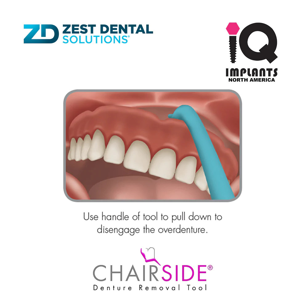 Zest CHAIRSIDE Essential Dental Removal Tool for Artifical Teeth, 10-Pack