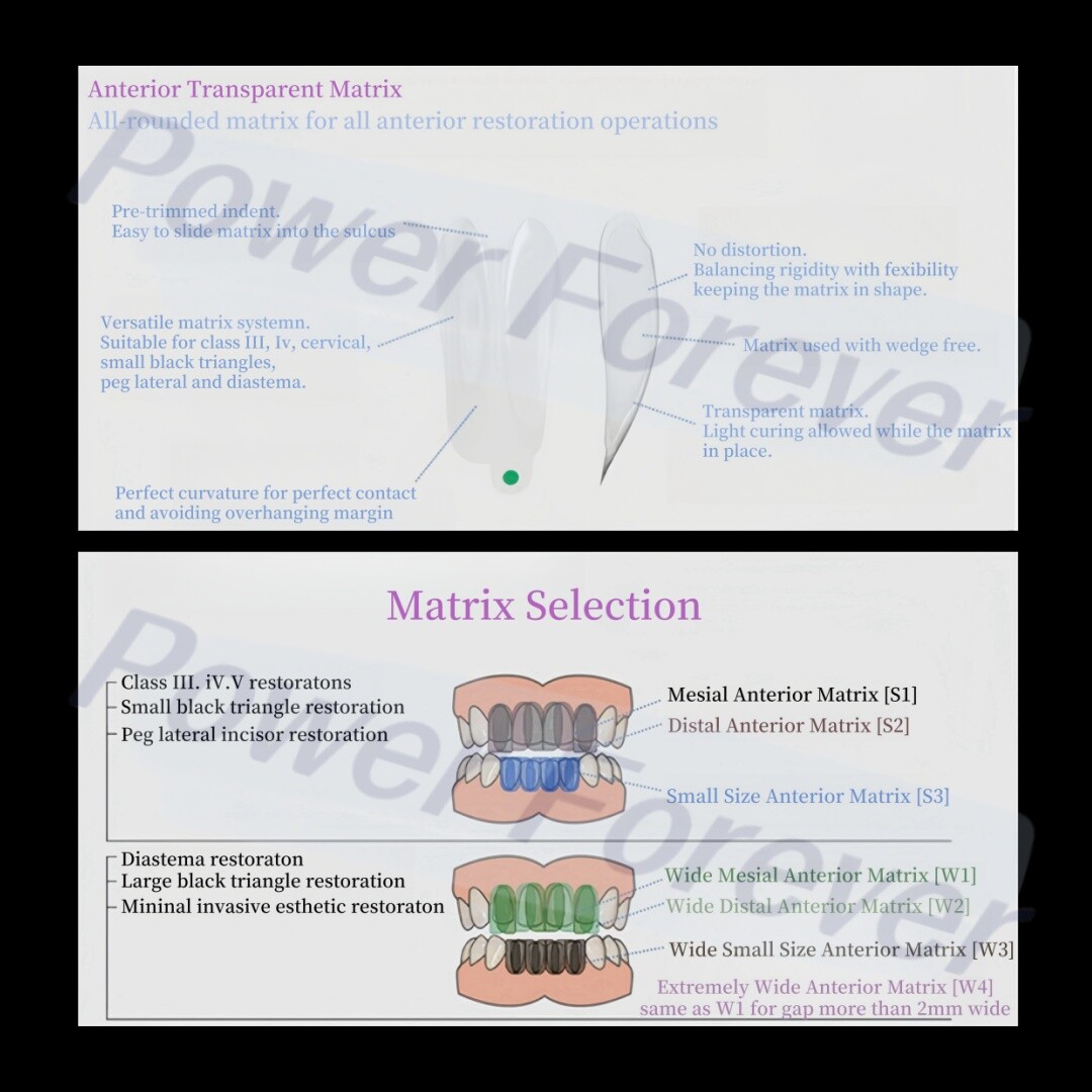 W2 Dental Anterior Distal Matrix Clear BT Bow Maxillary Matrices Contoured