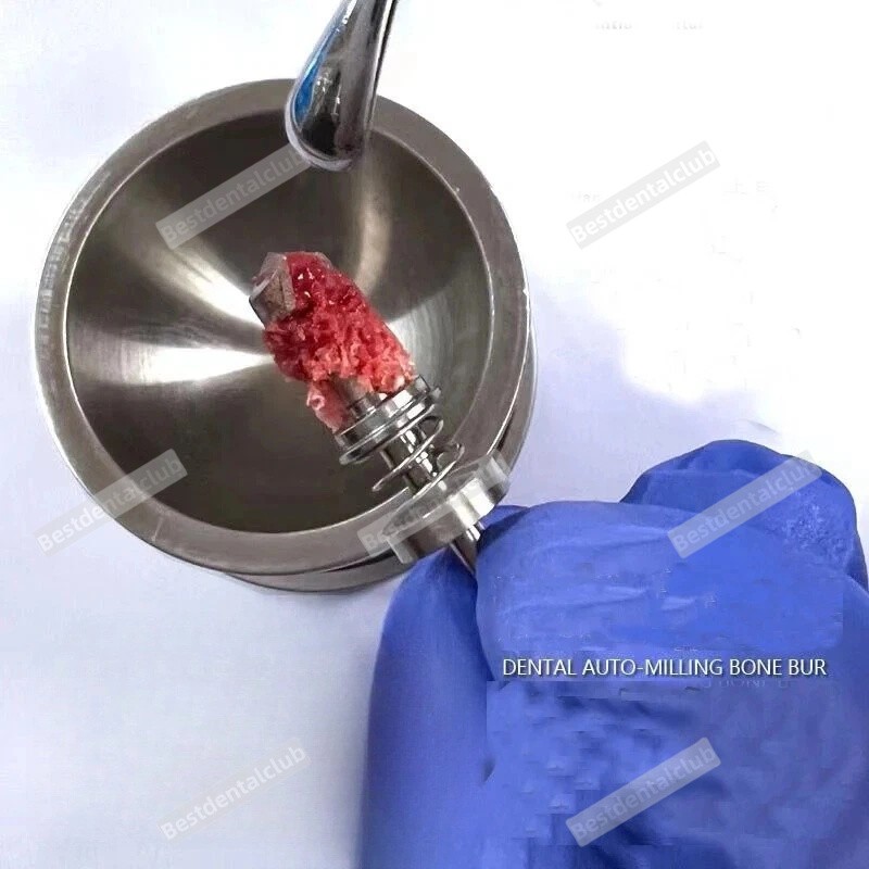 Dental Trephine Drills Implant Spring Harvest Drill GBR Collection 2.8MM