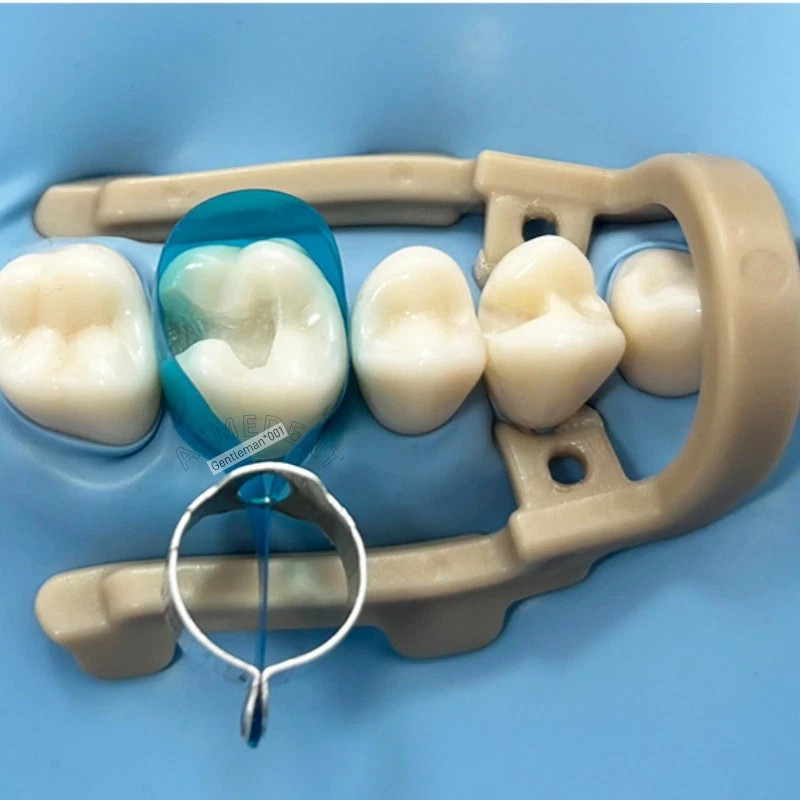 Blue Posterior Matrices Dental Matrix Bands Ring Molar Premoar Matrice Strips