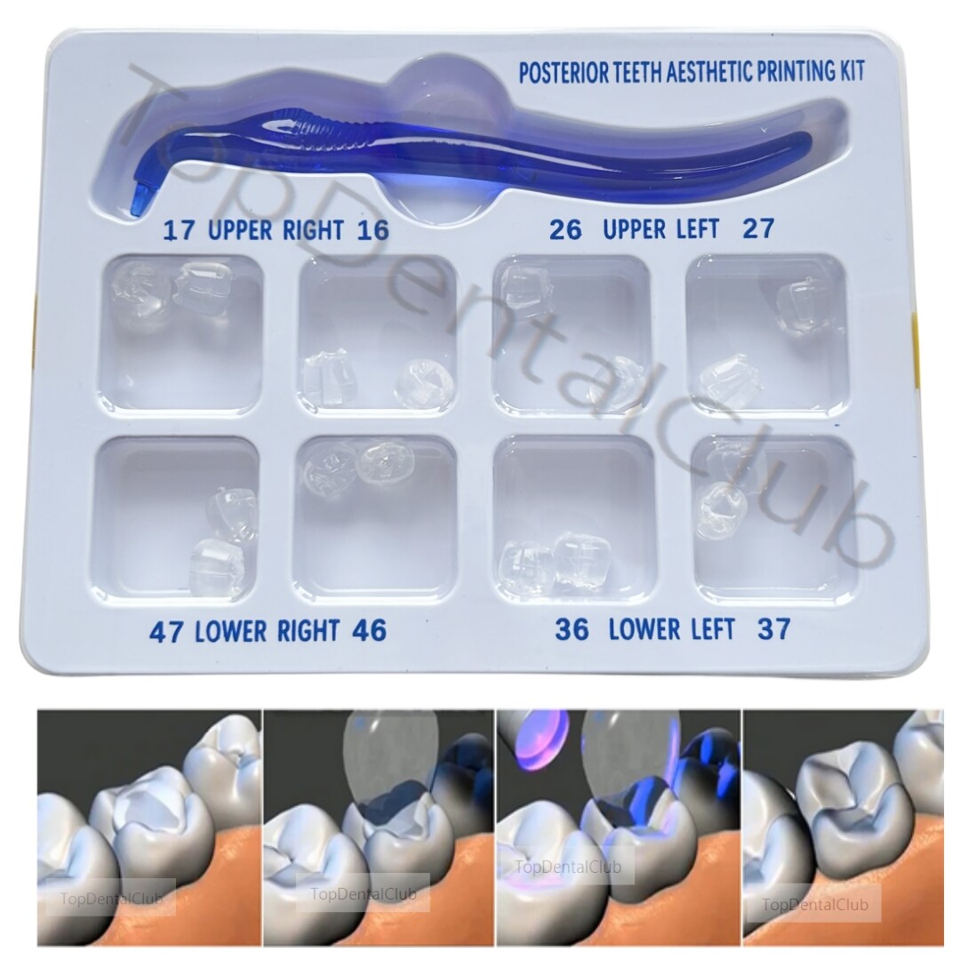 Dental Posterior Teeth Aesthetic Printing Mould Kit Restoration Filling Tools