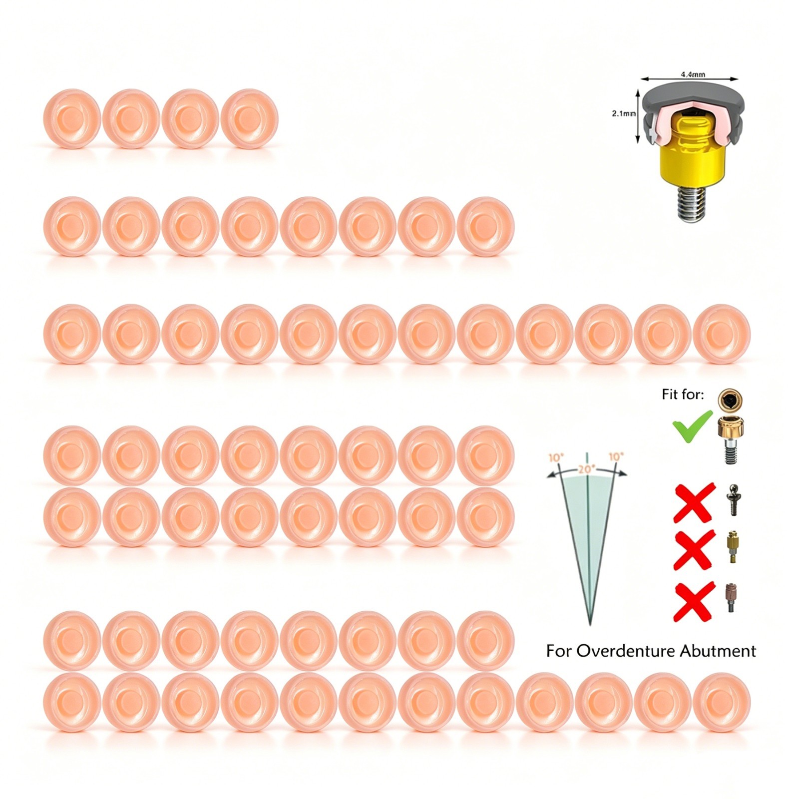 Dental Universal for Zest Locator System Replacement Retention Male Caps Insert
