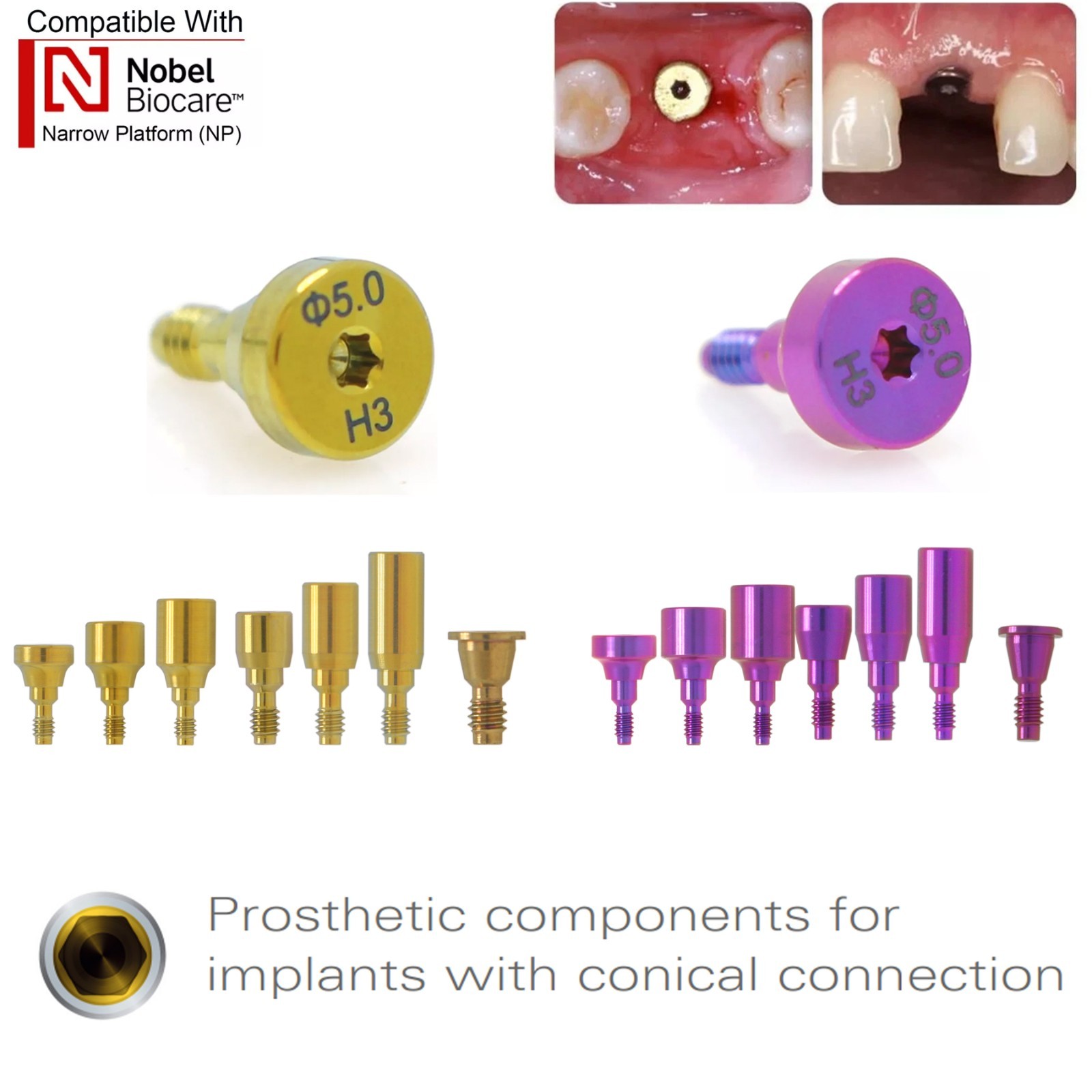 US Nobel Biocare Titanium Healing Abutment NP RP Internal Conical ∅3.6/5.0/6.0mm