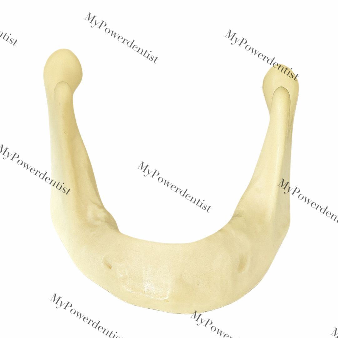 Dental Resin Alveolar Jaw Bone Replica Study Model Embed GBR Practice Blocks