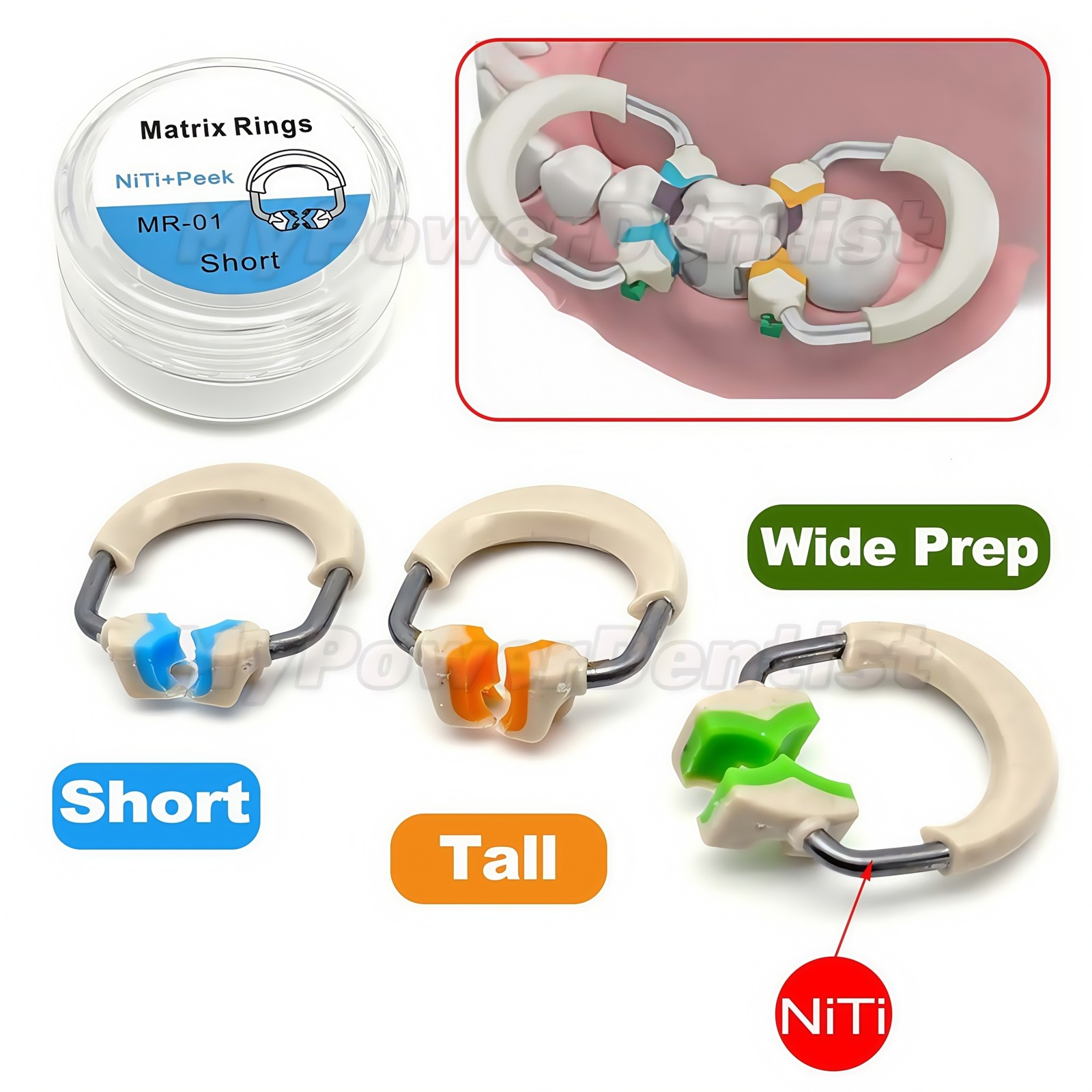Dental Matrix Bands Ring Sectional Matrice Titanium Alloy Clamp Fit Palodent V3