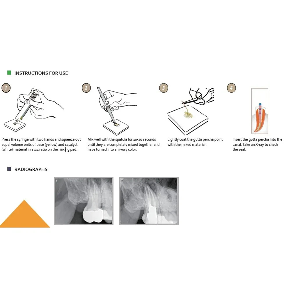 Diadent Dia Proseal Resin Based Radiopacity Material for Root Canal Sealing