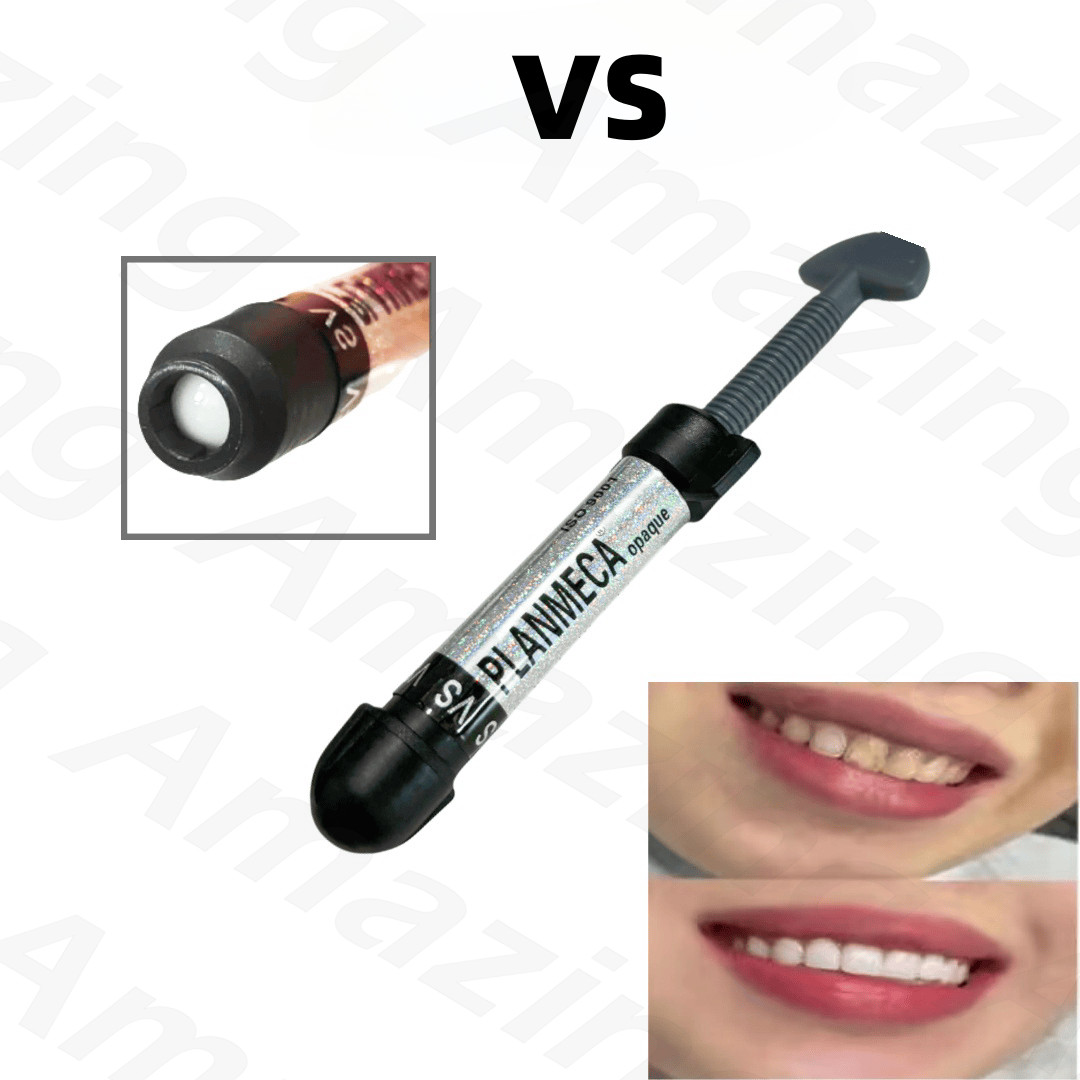 4.5g Dental Composite Resin Light Cure Bright White Veneer Hybrid Aesthetic