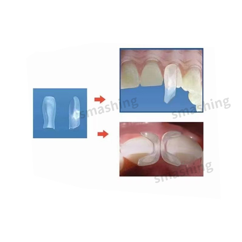 Dental Clear Matrix Anterior Matrices Bow BT Fits Bioclear L/M/S Matrice TOR VM