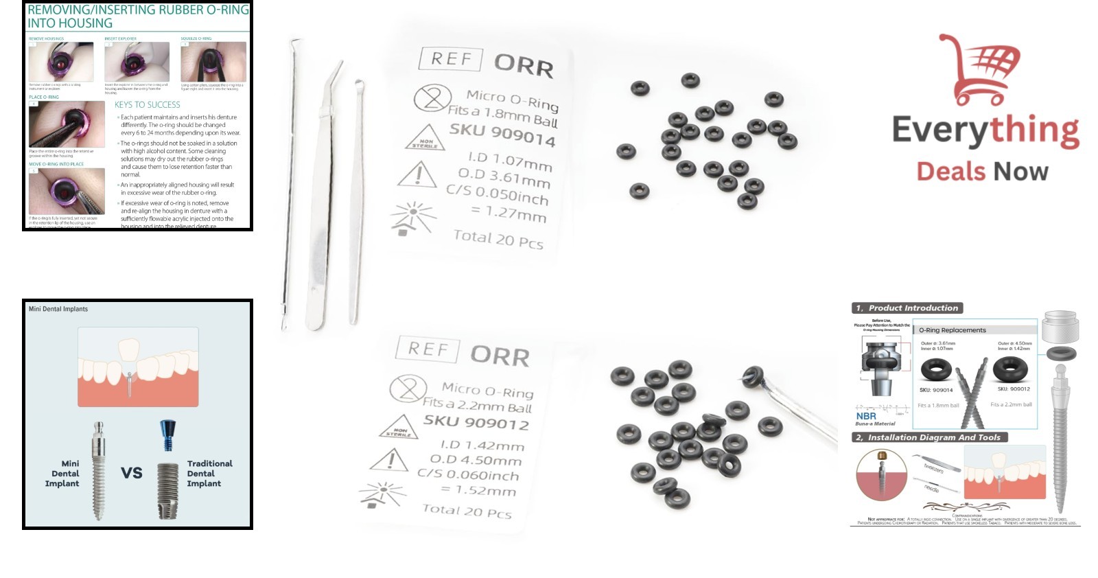 40pc Micro O-Ring Kit Mini Dental Implants Fits 1.8mm & 2.2mm Ball Attachments