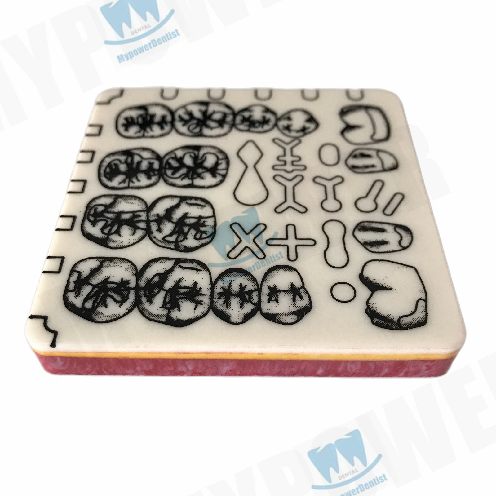 Dental Cavity Preparation/Vitro Decay Caries Model/Composite Resin Filling Model