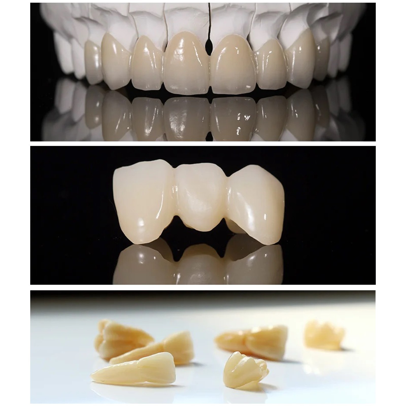 US Emax Dental Lab Lithium Disilicate Blocks CEREC CAD/CAM Blocks 5Pcs/Box LT-A2