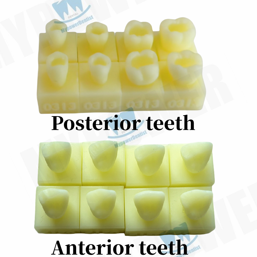 Dental Cavity Preparation/Vitro Decay Caries Model/Composite Resin Filling Model