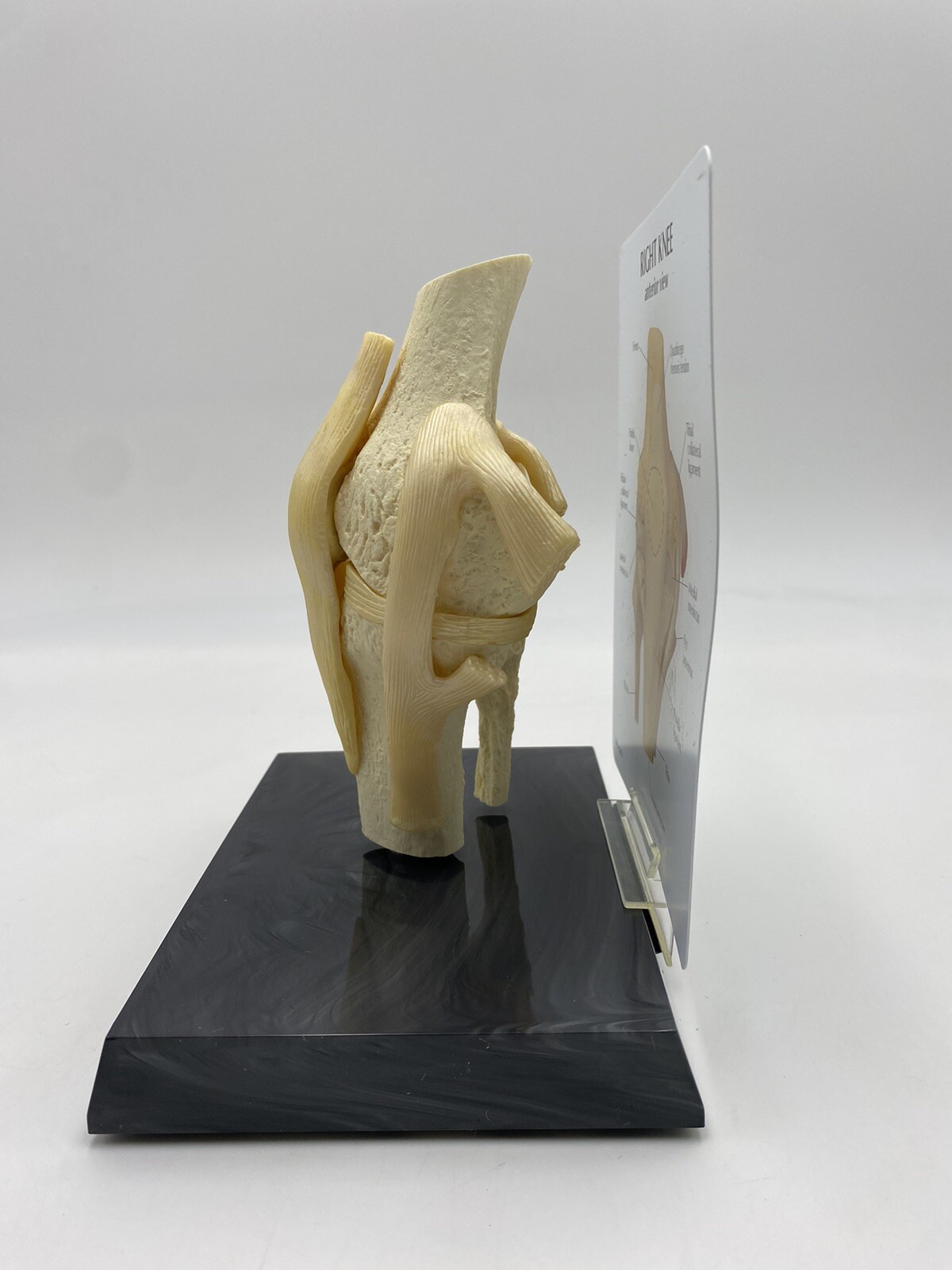GPI Anatomical – GP1000 – Basic Knee Join Model